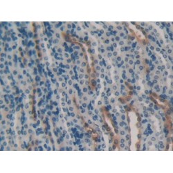 Heat Shock 70 kDa Protein 1B (HSPA1B) Antibody