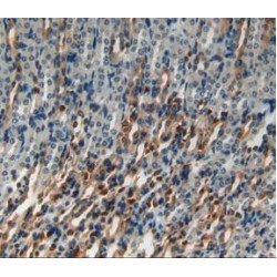 Heat Shock 70 kDa Protein 1B (HSPA1B) Antibody