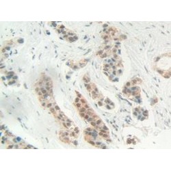 High Mobility Group Protein 1 (HMG1) Antibody