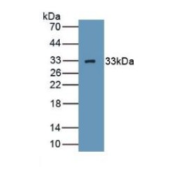 Complement C1q Binding Protein (C1QBP) Antibody