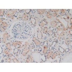 Complement C1q Binding Protein (C1QBP) Antibody