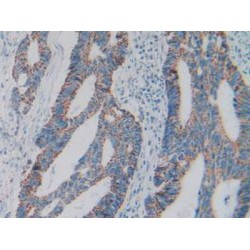 Complement C1q Binding Protein (C1QBP) Antibody