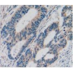 Interleukin 2 Receptor Alpha (IL2RA) Antibody