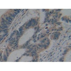 Interleukin 2 Receptor Alpha (IL2RA) Antibody