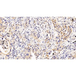 Interleukin 5 Receptor alpha (IL5RA) Antibody