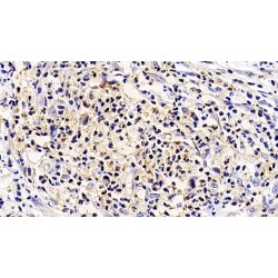 Interleukin 5 Receptor alpha (IL5RA) Antibody