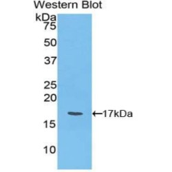 Ly1 Antibody Reactive Homolog (LYAR) Antibody