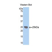 Western blot analysis of the recombinant protein.