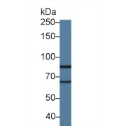 Western blot analysis of Rat Lung lysate, using Rat LOXL2 Antibody (1.5 µg/ml) and HRP-conjugated Goat Anti-Rabbit antibody (<a href="https://www.abbexa.com/index.php?route=product/search&amp;search=abx400043" target="_blank">abx400043</a>, 0.2 µg/ml).