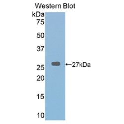 Lysyl Oxidase Like Protein 2 (LOXL2) Antibody