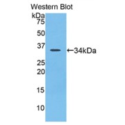 Western blot analysis of the recombinant protein.