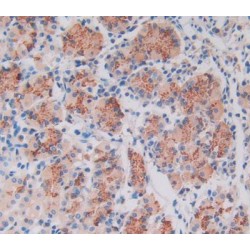 Lysyl Oxidase Like Protein 4 (LOXL4) Antibody