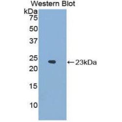 Neutrophil Cytosolic Factor 2 (NCF2) Antibody