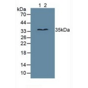 Western blot analysis of (1) Human Jurkat Cells and (2) Human MCF7 Cells.