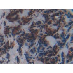 N-Methylpurine DNA Glycosylase (MPG) Antibody