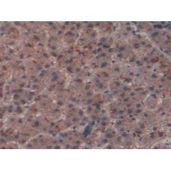 N-Methylpurine DNA Glycosylase (MPG) Antibody