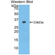 Western blot analysis of the recombinant protein.