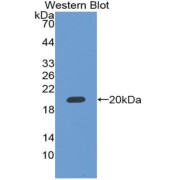 Western blot analysis of Human RBM20 protein.