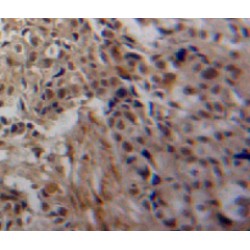 Transglutaminase 3, Epidermal (TGM3) Antibody