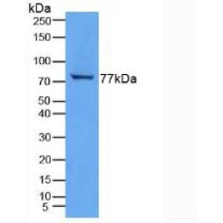 Transglutaminase 3, Epidermal (TGM3) Antibody