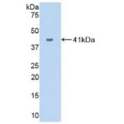 Western blot analysis of recombinant Human VCC1.