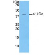 Western blot analysis of recombinant Human ACVR2A.