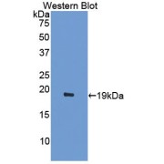 Western blot analysis of the recombinant protein.