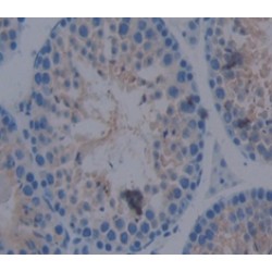 Activin A Receptor Type 2A (ACVR2A) Antibody