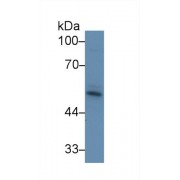 Western blot analysis of Cow Skeletal muscle lysate, using Cow ACVR2A Antibody (1 µg/ml) and HRP-conjugated Goat Anti-Rabbit antibody (<a href="https://www.abbexa.com/index.php?route=product/search&amp;search=abx400043" target="_blank">abx400043</a>, 0.2 µg/ml).