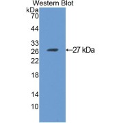 Western blot analysis of the recombinant protein.