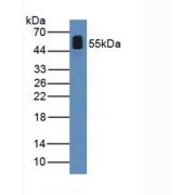 Western blot analysis of Human Serum.