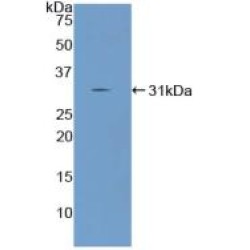 Angiopoietin-Related Protein 2 (ANGPTL2) Antibody