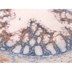 Angiopoietin-Related Protein 2 (ANGPTL2) Antibody