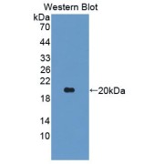 Western blot analysis of the recombinant protein.