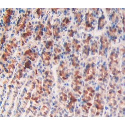 Angiopoietin-Related Protein 2 (ANGPTL2) Antibody