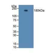 Western blot analysis of Human Lung Tissue.