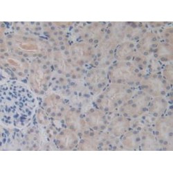 Bone Morphogenetic Protein 15 (BMP15) Antibody