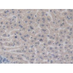 Bone Morphogenetic Protein 15 (BMP15) Antibody