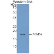 Western blot analysis of the recombinant protein.