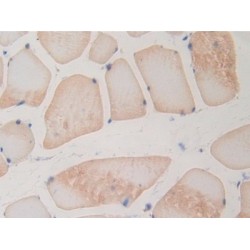 Bone Morphogenetic Protein 15 (BMP15) Antibody