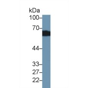 Western blot analysis of Rat Kidney lysate, using Rat CBG Antibody (2 µg/ml) and HRP-conjugated Goat Anti-Rabbit antibody (<a href="https://www.abbexa.com/index.php?route=product/search&amp;search=abx400043" target="_blank">abx400043</a>, 0.2 µg/ml).