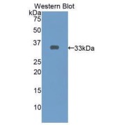 Western blot analysis of the recombinant protein.