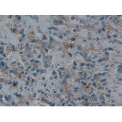 Endothelin Converting Enzyme 1 (ECE1) Antibody