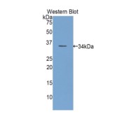 Western blot analysis of the recombinant protein.