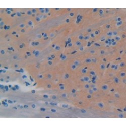 Endothelin Converting Enzyme 1 (ECE1) Antibody