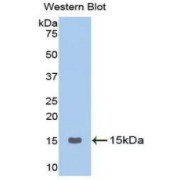 Western blot analysis of the recombinant protein.