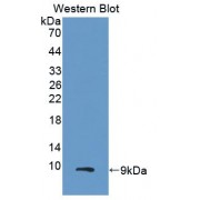 Western blot analysis of recombinant Human CXCL2.