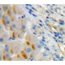 Immunoglobulin Associated Alpha (Iga) Antibody