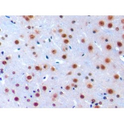 Interferon Regulatory Factor 1 (IRF1) Antibody