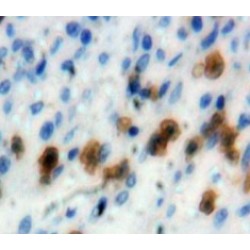 Interferon Regulatory Factor 4 (IRF4) Antibody